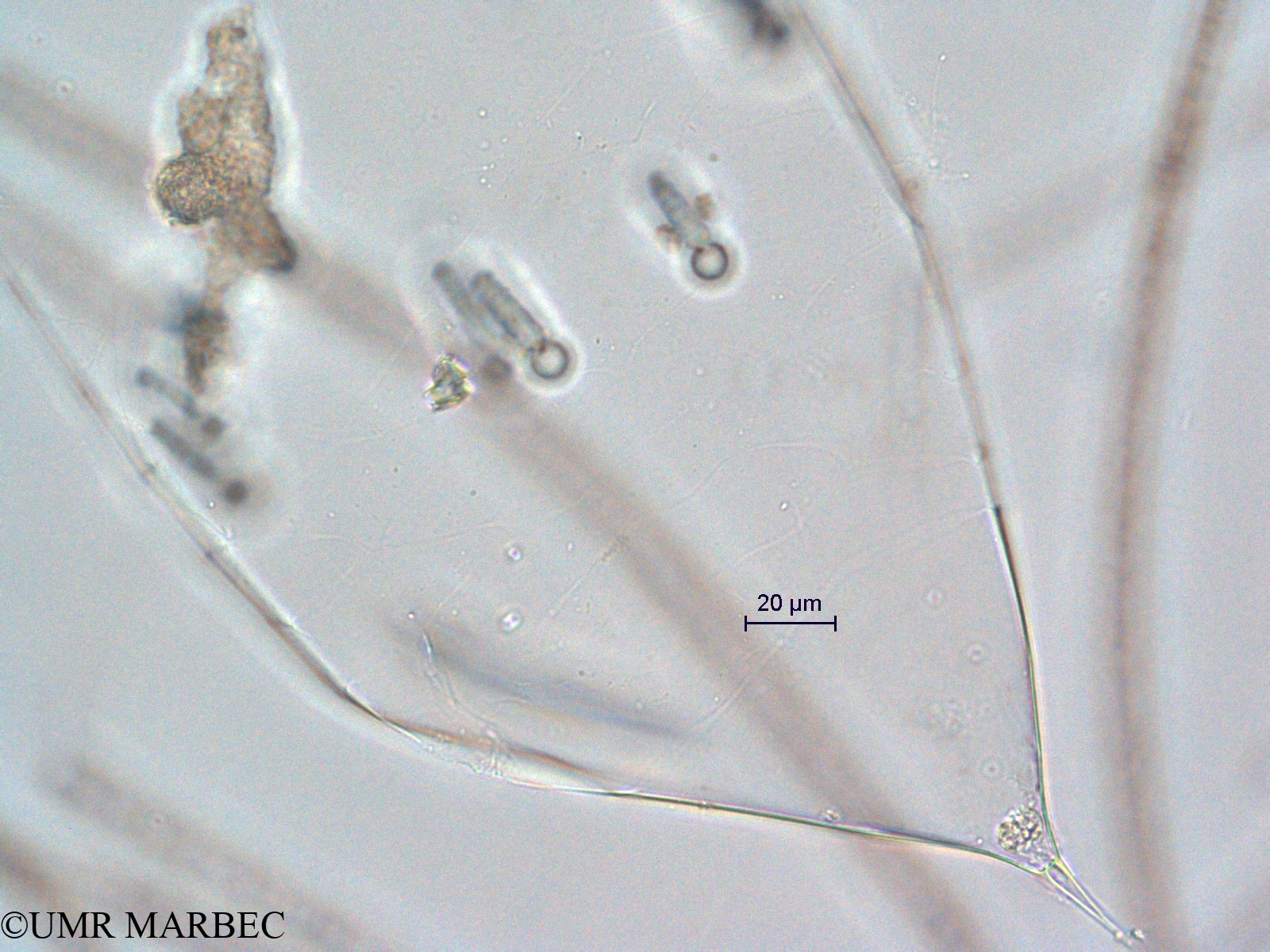 phyto/Scattered_Islands/all/COMMA April 2011/Rhizosolenia sp4 (3)(copy).jpg
